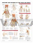 Anatomy and Injuries of the Hand and Wrist Anatomical Chart